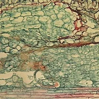 thumbnail for publication: Burrowing Nematode, Radopholus similis (Cobb 1893) Thorne (1949) (Nematoda: Secernentea: Tylenchida: Pratylenchidae: Pratylenchinae)